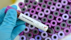 Casi 22.000 muertos en el mundo por coronavirus