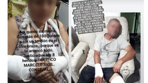 Mataron a un pitbull a balazos luego de que atacara a cuatro personas