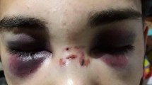 Imagen de Denuncian que un joven de Centenario fue agredido brutalmente por la policía