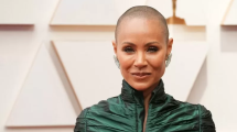 Imagen de Alopecia en mujeres: la lucha de Jada Pinkett Smith por visibilizar la enfermedad