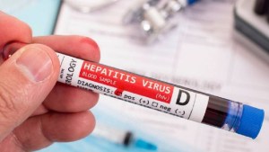 Hepatitis: la OMS preocupada por extraños casos en niños