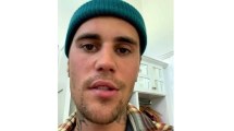 Imagen de Justin Bieber revela que padece un síndrome que le afecta la mitad de la cara