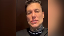 Imagen de Alex Caniggia, furioso por las críticas a su «nueva» mandíbula