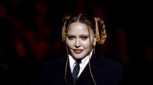 Imagen de Madonna fue internada en terapia intensiva por una «infección bacteriana grave»