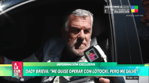 Imagen de Dady Brieva contó que estuvo a punto de operarse con Aníbal Lotocki: «Me salvé»