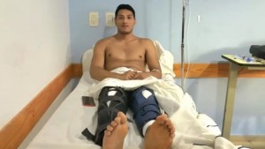 Un joven de La Plata asegura que por una una cirugía en la rodilla y por error le operaron las dos piernas