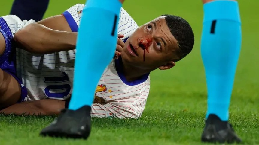 Mbappé fue reemplazado por una lesión en la naríz. (Rico Brouwer/Soccrates/Getty Images)