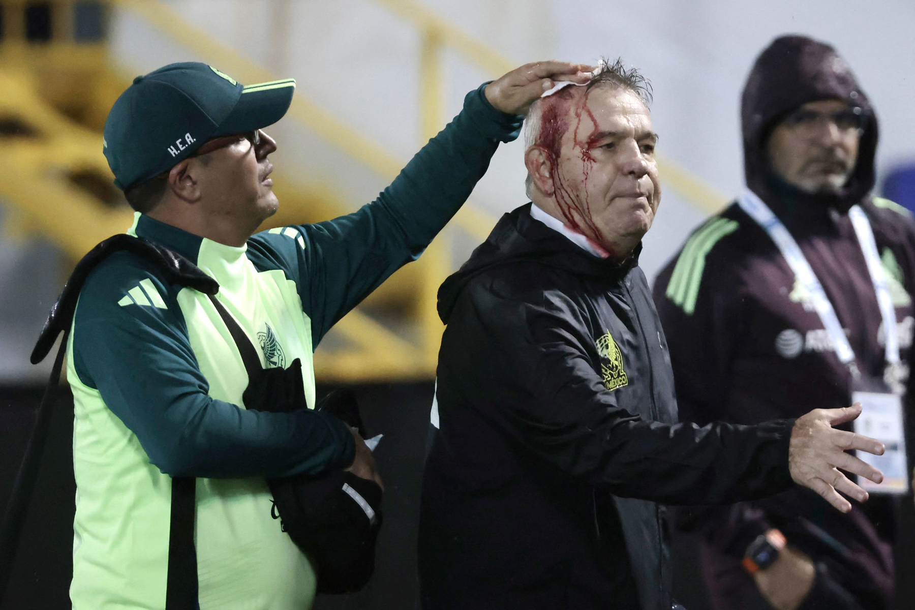 Aguirre DT de México, fue herido tras la derrota de su equipo. (Jhony Magallanes)